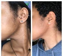 Load image into Gallery viewer, Facial Bar
