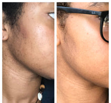 Load image into Gallery viewer, Facial Bar
